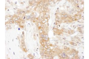 anti-VAMP (Vesicle-Associated Membrane Protein)-Associated Protein A, 33kDa (VAPA) (AA 125-175) antibody
