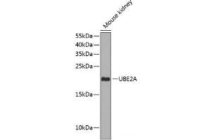 Western blot analysis of extracts of Mouse kidney using UBE2A Polyclonal Antibody at dilution of 1:1000.