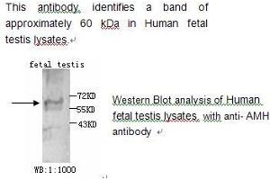 Image no. 1 for anti-Anti-Mullerian Hormone (AMH) antibody (ABIN790790) (AMH Antikörper)