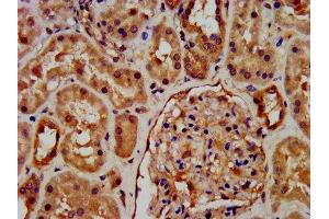 IHC image of ABIN7168264 diluted at 1:600 and staining in paraffin-embedded human kidney tissue performed on a Leica BondTM system.