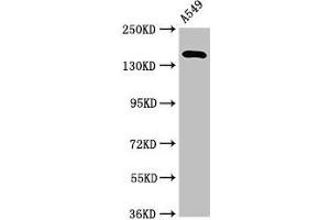 Western Blot Positive WB detected in: A549 whole cell lysate All lanes: A2ML1 antibody at 3. (A2ML1 Antikörper  (AA 625-751))