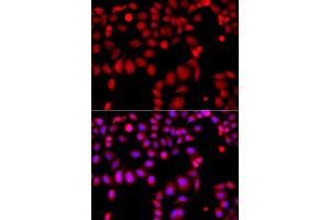 Immunofluorescence analysis of A549 cells using ARHGEF9 antibody (ABIN5975759). (Arhgef9 Antikörper)