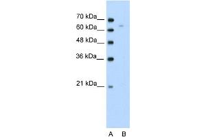 WB Suggested Anti-TOX Antibody Titration:  0. (TOX Antikörper  (N-Term))