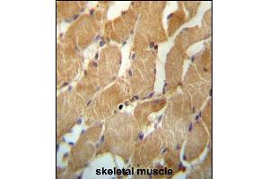 NDUFAF2 Antibody (Center) (ABIN657264 and ABIN2846359) immunohistochemistry analysis in formalin fixed and paraffin embedded human skeletal muscle followed by peroxidase conjugation of the secondary antibody and DAB staining.