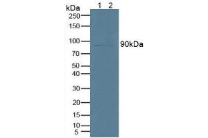 Figure. (PNPLA2 Antikörper  (AA 484-701))