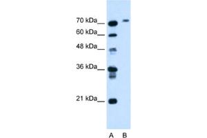 Western Blotting (WB) image for anti-Butyrylcholinesterase (BCHE) antibody (ABIN2462791) (Butyrylcholinesterase Antikörper)