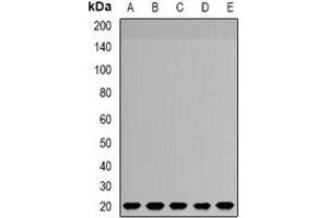 Western blot analysis of NDUFS4 expression in SW620 (A), MCF7 (B), HepG2 (C), mouse brain (D), rat liver (E) whole cell lysates. (NDUFS4 Antikörper)