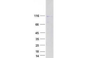 Validation with Western Blot (NAA25 Protein (Myc-DYKDDDDK Tag))