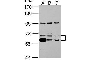 WB Image Sample (30 ug of whole cell lysate) A: A549 B: H1299 C: HCT116 7. (TXNRD1 Antikörper)