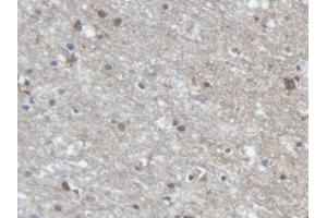 DAB staining on IHC-P; Samples: Human Cerebrum Tissue (PCDHA1 Antikörper  (AA 30-242))