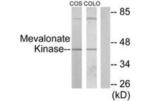 Western blot analysis of extracts from COS7/COLO205 cells, using Mevalonate Kinase Antibody. (MVK Antikörper  (AA 151-200))
