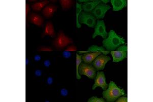 ABIN6257594 and ABIN6275624 staining Hela cells by IF/ICC.