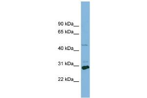 WB Suggested Anti-SLC16A1 Antibody Titration:  0. (SLC16A1 Antikörper  (Middle Region))
