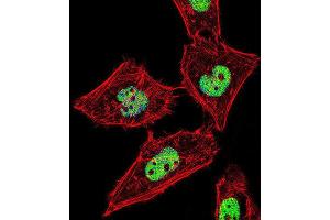 Immunofluorescence (IF) image for anti-RAR-Related Orphan Receptor A (RORA) antibody (ABIN2995882) (RORA Antikörper)