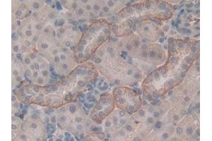 DAB staining on IHC-P; Samples: Rat Kidney Tissue (PITRM1 Antikörper  (AA 653-926))