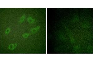 P-peptide - +Immunofluorescence analysis of HuvEc cells, using HER3/ErbB3 (Phospho-Tyr1222) antibody. (ERBB3 Antikörper  (pTyr1222))