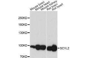 Western blot analysis of extracts of various cell lines, using SCYL2 antibody (ABIN6293549) at 1:3000 dilution. (SCYL2 Antikörper)