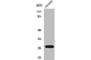 Western Blot analysis of COLO205 cells using NRIP3 Polyclonal Antibody (NRIP3 Antikörper  (C-Term))