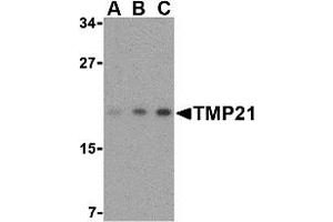 Western Blotting (WB) image for anti-Transmembrane Emp24-Like Trafficking Protein 10 (TMED10) (Middle Region) antibody (ABIN1031137) (TMED10 Antikörper  (Middle Region))
