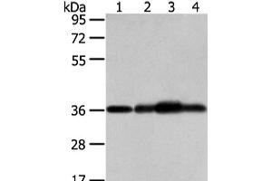 Western Blot analysis of Mouse brain tissue, hepg2, 293T and 231 cell using STX12 Polyclonal Antibody at dilution of 1/800 (Syntaxin 12 Antikörper)