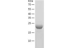 CDKN2C Protein (AA 1-168) (His tag)