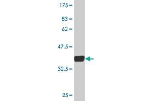 Metabotropic Glutamate Receptor 5 Antikörper  (AA 419-518)