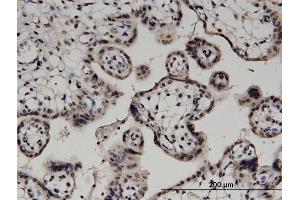 Immunoperoxidase of monoclonal antibody to DGKA on formalin-fixed paraffin-embedded human placenta. (DGKA Antikörper  (AA 1-735))