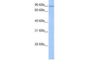 WB Suggested Anti-UNC84A Antibody Titration:  0. (SUN1 Antikörper  (N-Term))