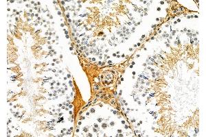 ABIN6260068 and ABIN6279106 at 1/100 staining Rat testis tissue by IHC-P. (ACER1 Antikörper  (Internal Region))