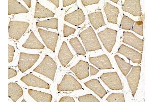 ABIN7097156 and ABIN7101224 at 1/100 staining rat muscle tissue by IHC-P. (CPQ Antikörper)