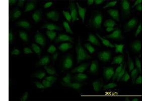 Image no. 3 for anti-Decapping Enzyme, Scavenger (DCPS) (AA 1-338) antibody (ABIN599227) (DCPS Antikörper  (AA 1-338))