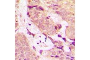 Immunohistochemistry (IHC) image for anti-TNF Receptor-Associated Factor 2 (TRAF2) antibody (ABIN7308436) (TRAF2 Antikörper)