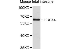 Western blot analysis of extracts of human fetal intestine, using GRB14 antibody (ABIN3048328).
