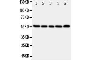 Western Blotting (WB) image for anti-Tachykinin Receptor 1 (TACR1) (AA 231-245), (Middle Region) antibody (ABIN3044262) (TACR1 Antikörper  (Middle Region))
