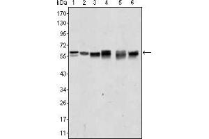 Western blot analysis using AKT2 mouse mAb against A431 (1), Jurkat (2), HEK293 (3), A549 (4), MCF-7 (5) and PC-12 (6) cell lysate. (AKT2 Antikörper)