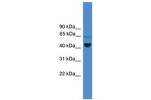 Image no. 1 for anti-Zinc Finger Protein 265 (Zranb2) (AA 101-150) antibody (ABIN6745453) (ZNF265 Antikörper  (AA 101-150))