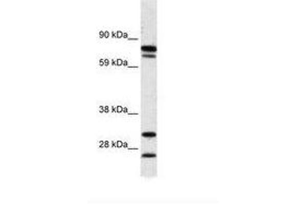 ZNF606 Antikörper  (AA 38-87)
