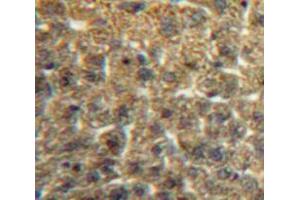 IHC-P analysis of Liver tissue, with DAB staining. (CCL3 Antikörper  (AA 24-92))