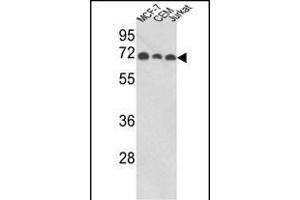 ABI1 Antikörper  (N-Term)