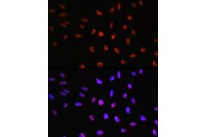 Immunofluorescence analysis of U-2 OS cells using TCF4 Rabbit pAb (ABIN3021529, ABIN3021530, ABIN3021531, ABIN1513591 and ABIN6215200) at dilution of 100 (40x lens). (TCF4 Antikörper  (AA 400-500))