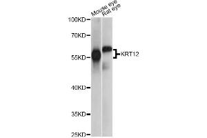 Western blot analysis of extracts of various cell lines, using KRT12 antibody. (KRT12 Antikörper)