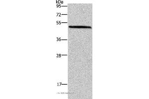 Western blot analysis of Mouse brain tissue, using HOMER1 Polyclonal Antibody at dilution of 1:400 (HOMER1 Antikörper)