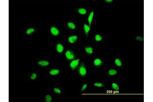 Immunofluorescence of monoclonal antibody to YY1 on HeLa cell. (YY1 Antikörper  (AA 221-320))