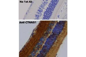 Immunohistochemistry (IHC) image for anti-Catenin, beta (CATNB) (C-Term) antibody (ABIN6254224) (beta Catenin Antikörper  (C-Term))