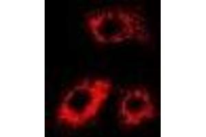 Immunofluorescent analysis of Citrate Synthase staining in MCF7 cells. (CS Antikörper)