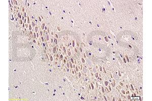 Formalin-fixed and paraffin embedded rat brain labeled with Anti-SEMA7A/CD108 Polyclonal Antibody, Unconjugated (ABIN749363) at 1:200 followed by conjugation to the secondary antibody and DAB staining (SEMA7A Antikörper  (AA 351-450))