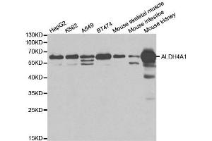 Western blot analysis of extracts of various cell lines, using ALDH4A1 antibody. (ALDH4A1 Antikörper  (AA 354-563))