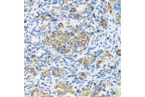 Immunohistochemistry of paraffin-embedded rat ovary using F antibody (ABIN3016158, ABIN3016159, ABIN3016160 and ABIN6219586) at dilution of 1:100 (40x lens). (APOBEC3F Antikörper  (AA 1-65))