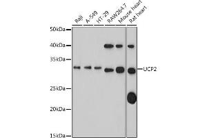 Western blot analysis of extracts of various cell lines, using UCP2 antibody (ABIN1683207, ABIN3018658, ABIN3018659 and ABIN5664678) at 1:1000 dilution. (UCP2 Antikörper)