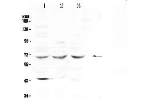Western blot analysis of SPHK2 using anti-SPHK2 antibody . (SPHK2 Antikörper  (AA 215-269))